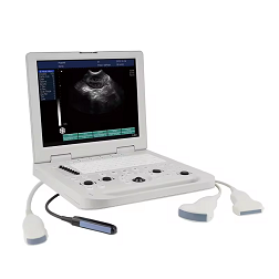 M217 Laptop Ultrasound Scanner