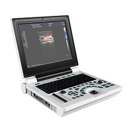 ME20 Laptop Color Doppler Ultrasound Scanner